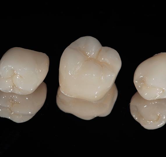 Three dental crowns in Springfield sitting in a row