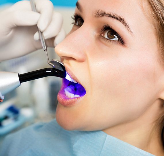 Dentist holding dental mirror and applying UV light to woman’s filling