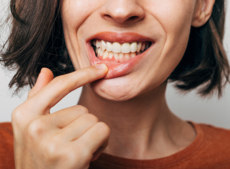 Woman pulling lip down to show gums